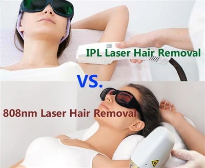 Sigurnost i razlike između IPL i 808nm laserskog uklanjanja dlaka